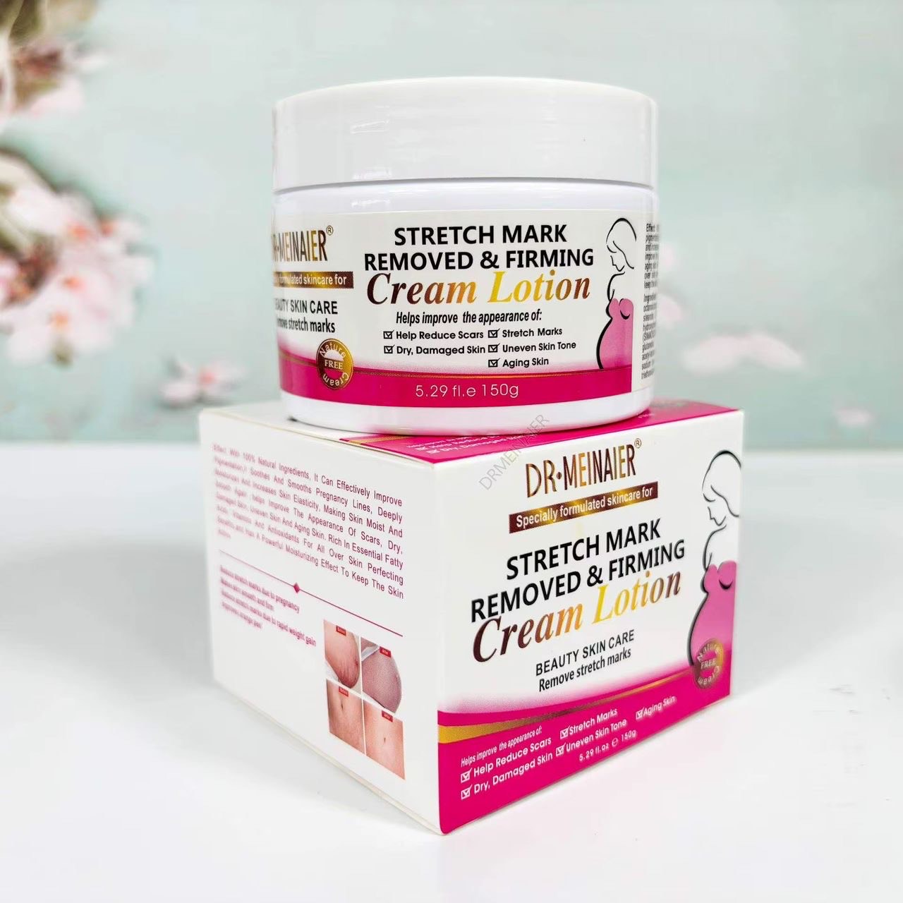 Stretch Mark Lotion